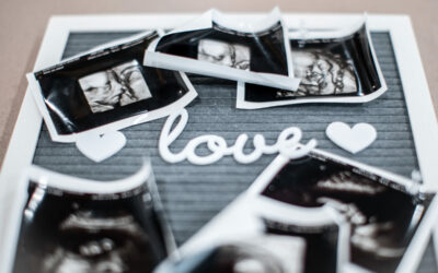 What to Expect During a Mobile 3d/4d ultrasound session